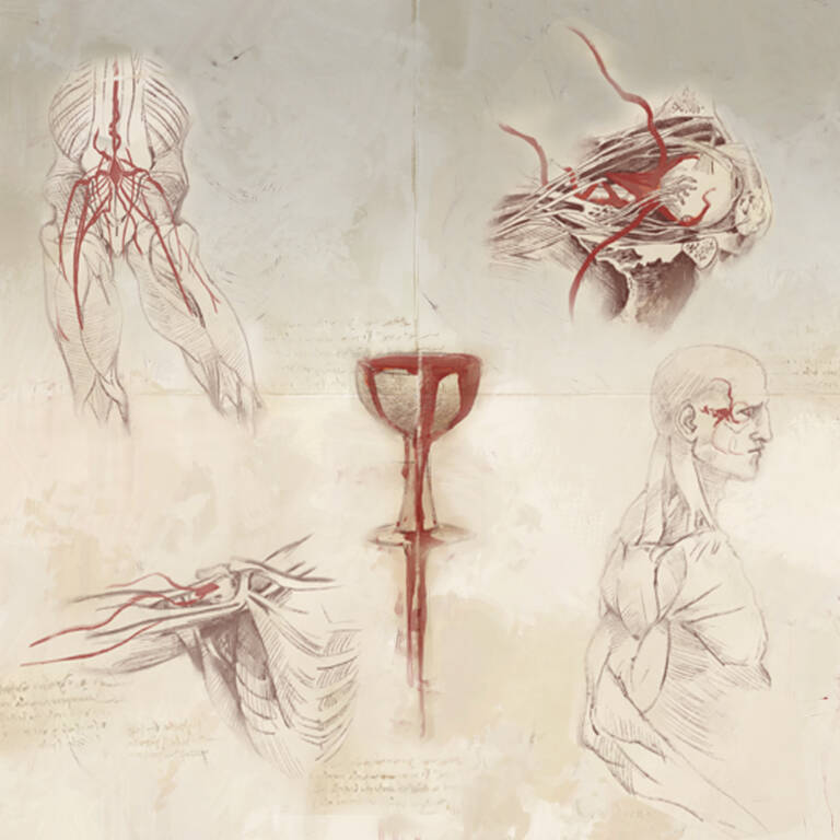 The Orders – IMPLANTS